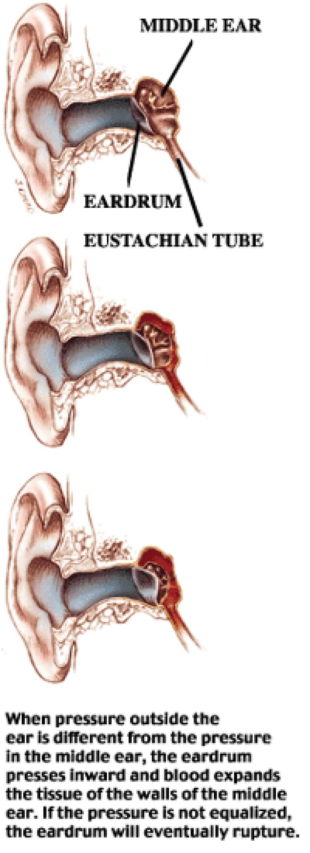 scuba diving ear pain
