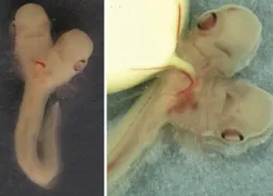 two headed shark dicephaly