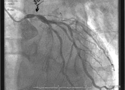 heart-attack-cath-eric-douglas-scuba-diving.jpg.webp