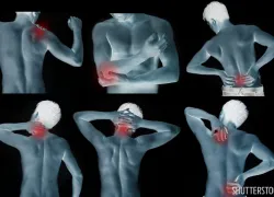 scuba_diving_doctor_dcs_cramps.jpg.webp