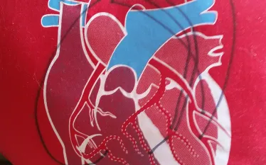 heart-surgery-scuba-diving-pillow-diagram-teaser.jpg.webp